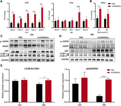 Human Umbilical Cord Blood Mononuclear Cells Ameliorate CCl4-Induced Acute Liver Injury in Mice via Inhibiting Inflammatory Responses and Upregulating Peripheral Interleukin-22